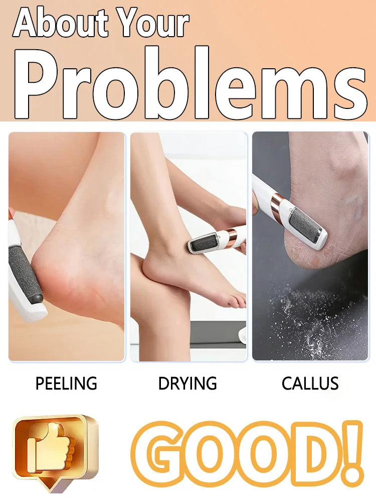 Electric foot grinder,Electric Callus Remover for Feet,Foot Exfoliator Foot Scrubber Pedicure Tools,Removes Dry Skin.Unisex